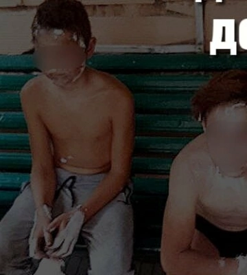 На Одещині троє підлітків дістали опіки від вибуху пороху