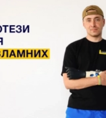 Львівські медики встановили пацієнту перший біонічний протез руки