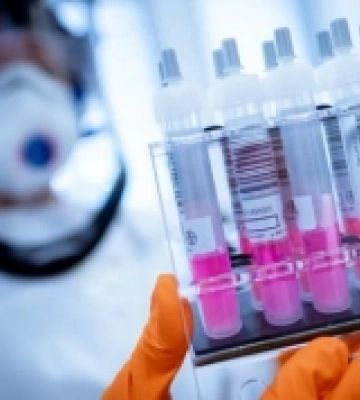 Коронавірус на Рівненщині: 1738 нових хворих та чотири смерті