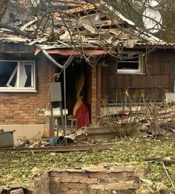 Помер чоловік, поранений вчора під час обстрілу Харківщини. ФОТО