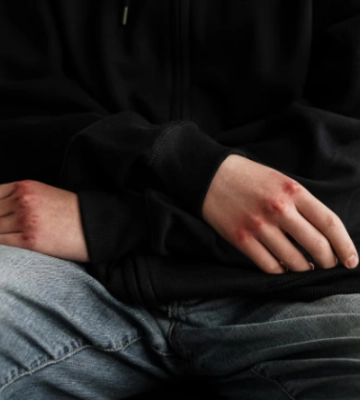 В Хмельницком в общежитии жестоко избили 15-летнего студента — подросток получил подозрение