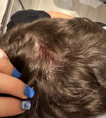 На очах у дитини двоє чоловіків у Чернівцях жорстоко побили переселенця за російську мову