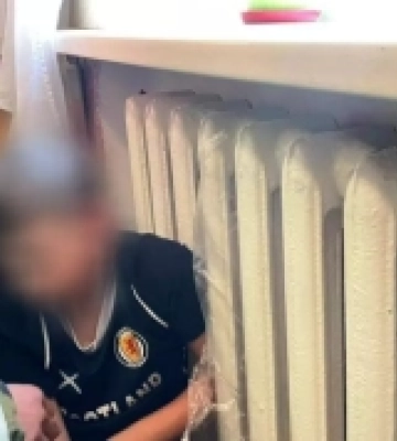 На Кіровоградщині рятувальники допомогли хлопчику, руку якого затисло між секціями батареї