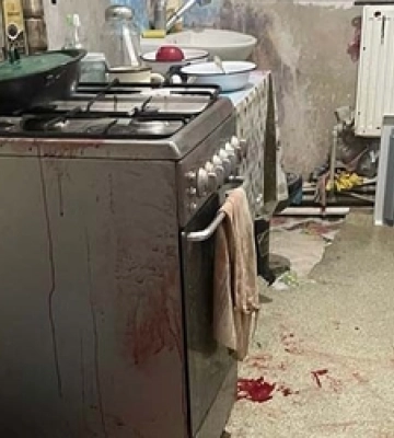 У руках жителя Тернопільщини вибухнув боєприпас часів Другої світової війни
