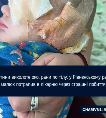 У дитини виколоте око, рани по тілу: у Рівненському районі малюк потрапив в лікарню через страшні побиття