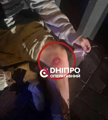 Вибухи у Дніпрі: постраждав 14-річний хлопець