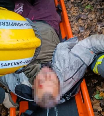 У Чернівцях рятувальники витягнули з яру постраждалого 64-річного чоловіка