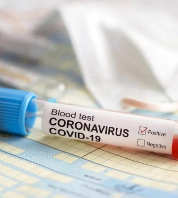На Миколаївщині захворюваність на грип та COVID-19 залишається нижчою за епідпоріг