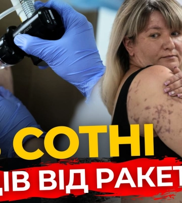 Як у Львові рятують жінку зі Словʼянська | ПравдаТУТ Львів