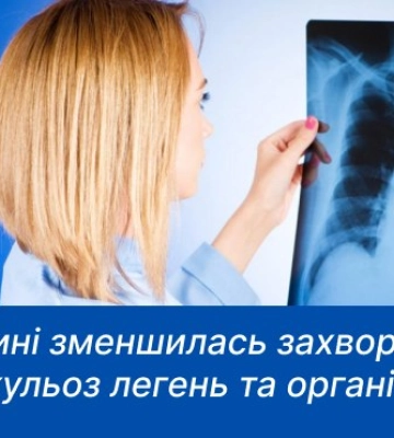 На Сумщині зменшилась захворюваність на туберкульоз