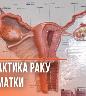 Відомо, скільки жінок на Рівненщині мають рак шийки матки: як попередити захворювання