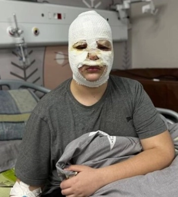 Во Львове трое мальчиков попали в больницу из-за самодельной &quot;петарды&quot;