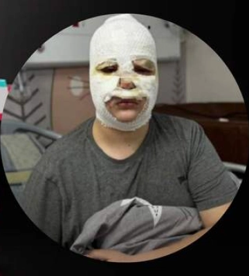 Из-за опасного видео с TikTok во Львове за неделю госпитализировали 3 детей: что произошло