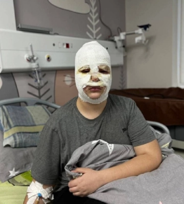 У Львові діти травмувалися під час хімічних експериментів