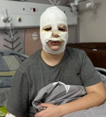 На Львівщині прикарпатець наїхав на 61-річну жінку: вона у лікарні (ФОТО)