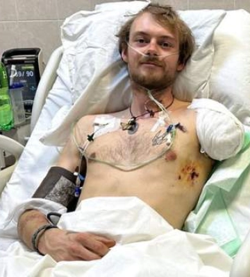 «Не иначе, как военное преступление». 28-летний волонтер из Британии потерял руку и ногу после атаки РФ на эвакуационное авто&amp;hellip;