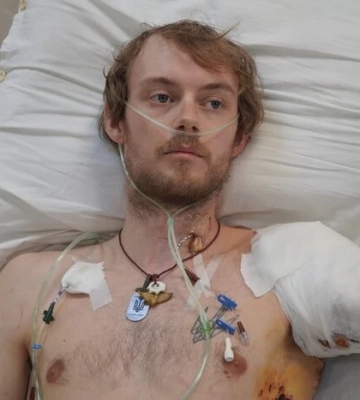 У Дніпрі врятували британського волонтера, який був важко поранений під час евакуації мирних мешканців (Відео)