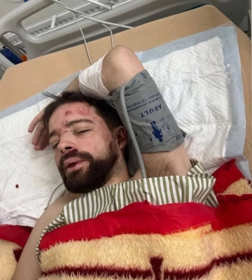 Біля Києва знайшли побитого викладача Львівського університету
