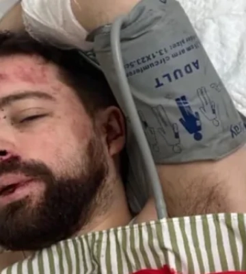 Переломи черепа та набряк мозку: Під Києвом в критичному стані знайшли викладача, якого мобілізували у Львові
