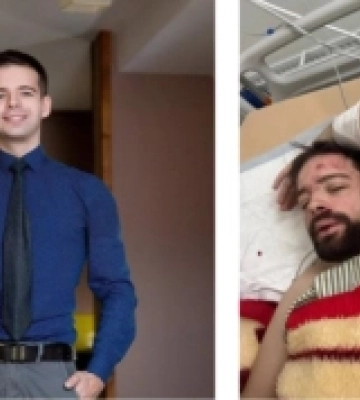 Під Києвом знайшли викладача львівського університету з важкими травмами: що відомо