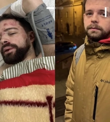 Вистрибнув з автомобіля: в поліції з&#039;ясували обставини травмування мобілізованого львів&#039;янина