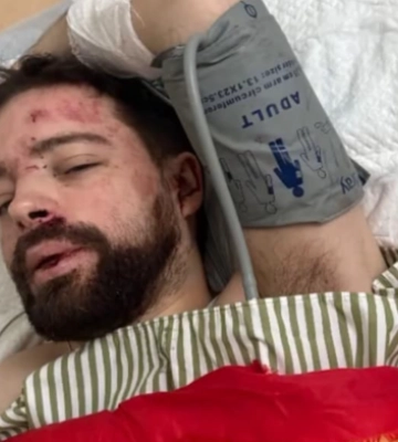 Львівського вченого знайшли під Житомиром із переломом черепа після "експрес-мобілізації": "Вискочив із машини..."
