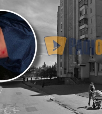 У Рівному стріляли в дітей: поранили 14-річного хлопця