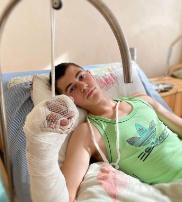 Львівські травматологи врятували 17-річному  руку хлопцеві зі складними переломами
