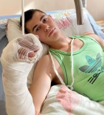 Рука была полностью изломана: медикам Львова удалось сохранить конечность 17-летнему юноше