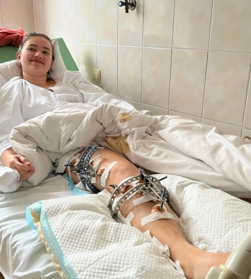 Львівські ортопеди за місяць наростять 18-річній львів’янці 4 см кістки на нозі