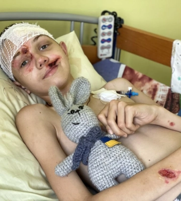 Обломок проломил череп, 9 дней был в коме: как удалось выжить 12-летнему Стасу из Харьковской области – сюжет (Видео)