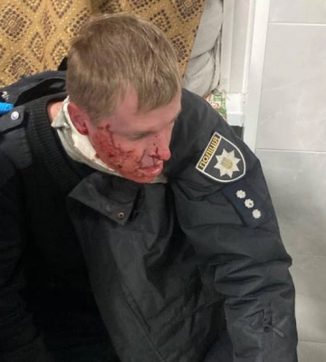 Обстріляно житлові будинки Запоріжжя