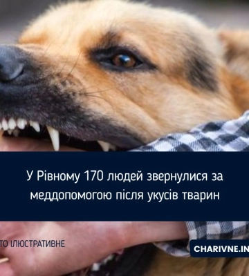 У Рівному 170 людей звернулися за меддопомогою після укусів тварин