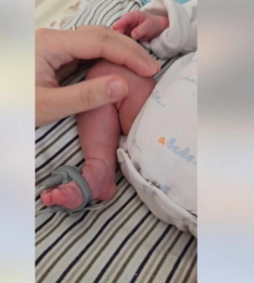У Рівному виписали «поспішайку», який народився з вагою менш ніж 900 грамів