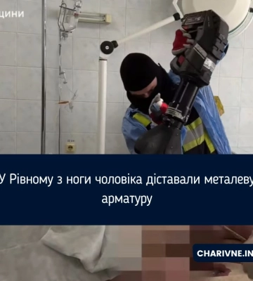У Рівному з ноги чоловіка діставали металеву арматуру (ВІДЕО)