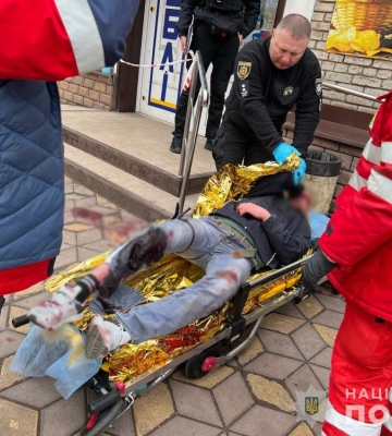 У Запоріжжі поліцейський застосував табельну зброю проти нападника, який кинувся на нього з ножем (ФОТО)