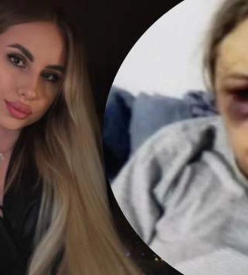 У лікарні в Чернівцях померла 27-річна дівчина, яку жорстоко побили