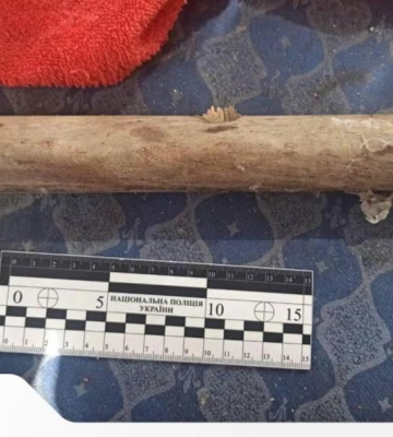Конфлікт через спадщину: у Вараші чоловік побив брата дерев’яною палицею