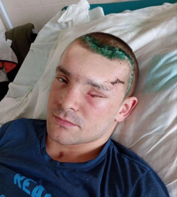 22-річний воїн із Волині отримав важке поранення: потрібна допомога