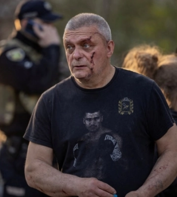 Через ворожі атаки по Купʼянщині постраждали четверо жінок