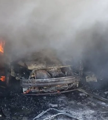 В Ужгороді в гаражі згорів автомобіль, постраждав власник