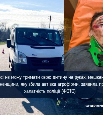 Я досі не можу тримати свою дитину на руках: мешканка Рівненщини, яку збила автівка агрофірми, заявила про халатність поліції (ФОТО) Я досі не можу тримати свою дитину на руках: мешканка Рівненщини, яку збила автівка агрофірми, заявила про халатність поліції (ФОТО)