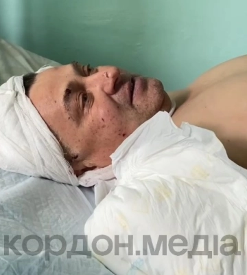 Серед поранених внаслідок атаки БПЛА на автобус у Білопіллі — працівник “Сумиобленерго”