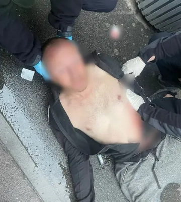 Чоловіка побили на пункті збору у Вінницькому ТЦК: військкомат каже, що він перебував &quot;у розшуку&quot;