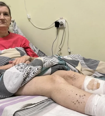 У Херсоні російські дрони навмисно атакують цивільних: десятки постраждалих, ампутації, поранені лікарі
