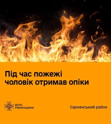 На Рівненщині чоловік отримав опіки внаслідок пожежі