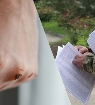 Группа мужчин напала на работников ТЦК в Кременчуге – военные скрылись на машине
