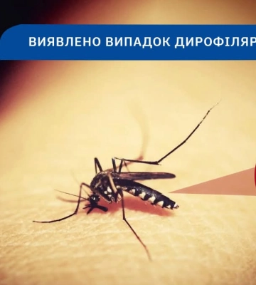 З ноги жінки з Полісся видалили довжелезного гельмінта