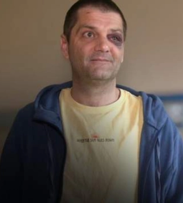 На Львівщині побили військового: нападникам загрожує до 4 років ув’язнення