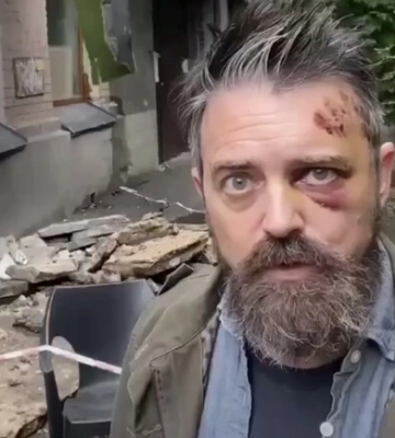 В Киеве на американца упал балкон у подъезда многоэтажки